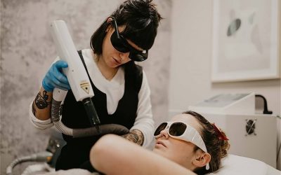DUDAS FRECUENTES – ELIMINACIÓN DE TATUAJES